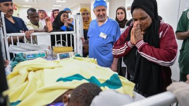السعودية إعلان نجاح فصل التوأم التنزاني «لايتيينس ولوفنس»