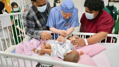 ‏إنفاذًا لتوجيهات خادم الحرمين الشريفين وولي العهد.. بدء عملية فصل التوأم الملتصق الفيجي "جسبيلي وديسيسيا" في الرياض،