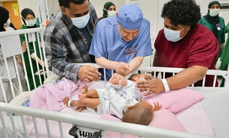 ‏إنفاذًا لتوجيهات خادم الحرمين الشريفين وولي العهد.. بدء عملية فصل التوأم الملتصق الفيجي "جسبيلي وديسيسيا" في الرياض،